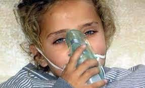 طفلة سورية تنشقت غاز الكلور السام الذي أطلقه النظام على كفر زيتا