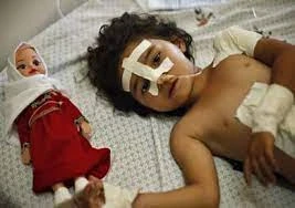 طفلة غزاوية اصيبت بقصف إسرائيلي