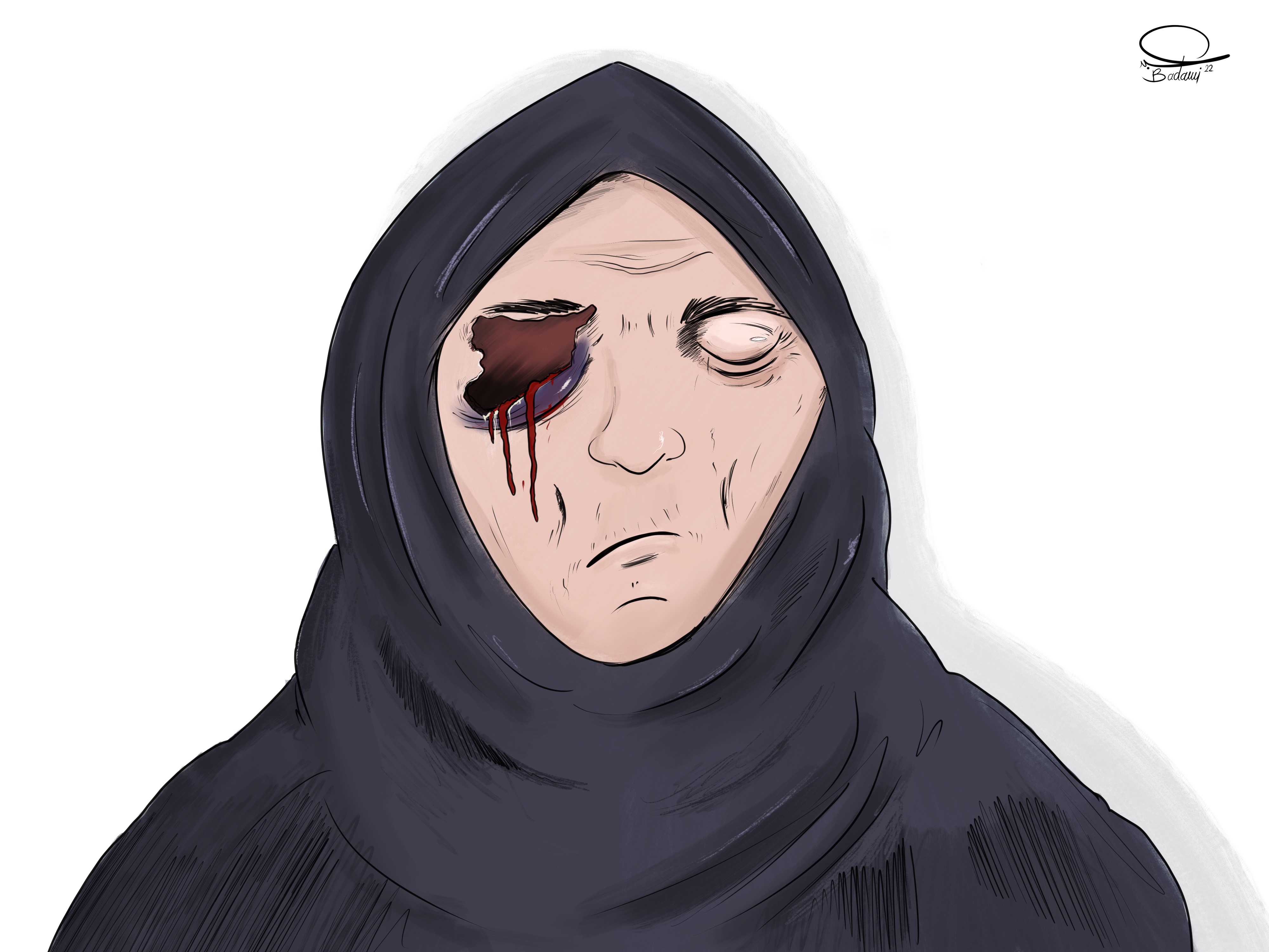 سيدة سورية سبعينية تتعرض للضرب من قبل شاب تركي(خاص بالسوري اليوم)